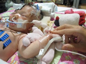 addison's heart  125